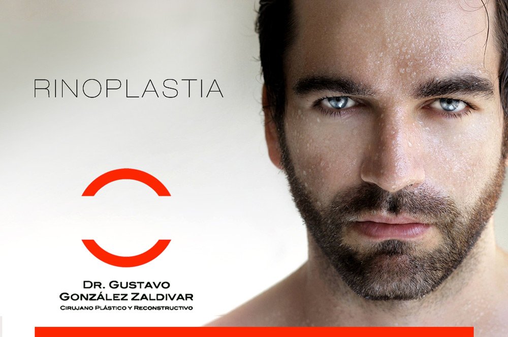CampaÃ±a EstÃ©tica Redes Sociales